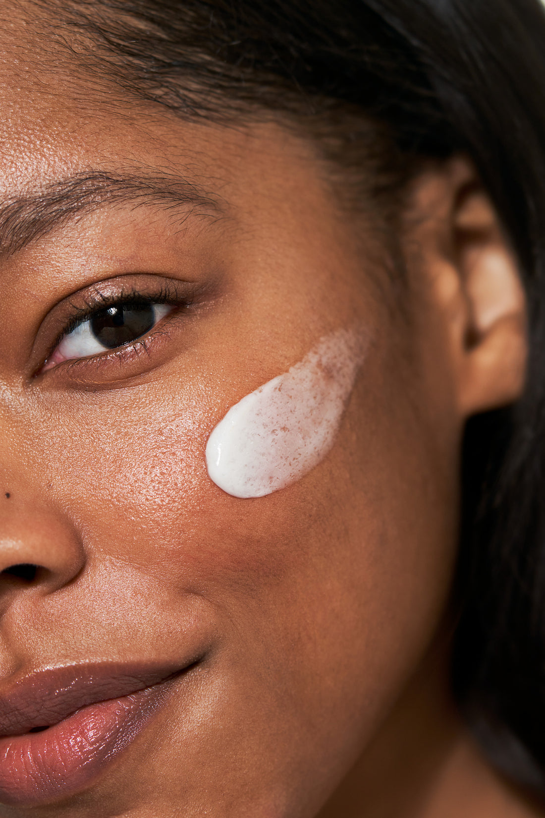 Close-up of a woman's face with a white cream applied to her cheek.